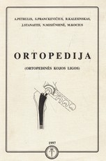 Ortopedija (ortopedinės kojos ligos)